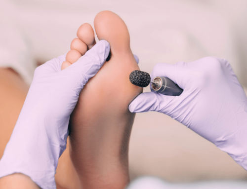 Medisch pedicure
